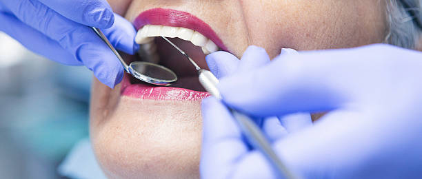 Best Emergency Treatment for Toothache in Jefferson, MD